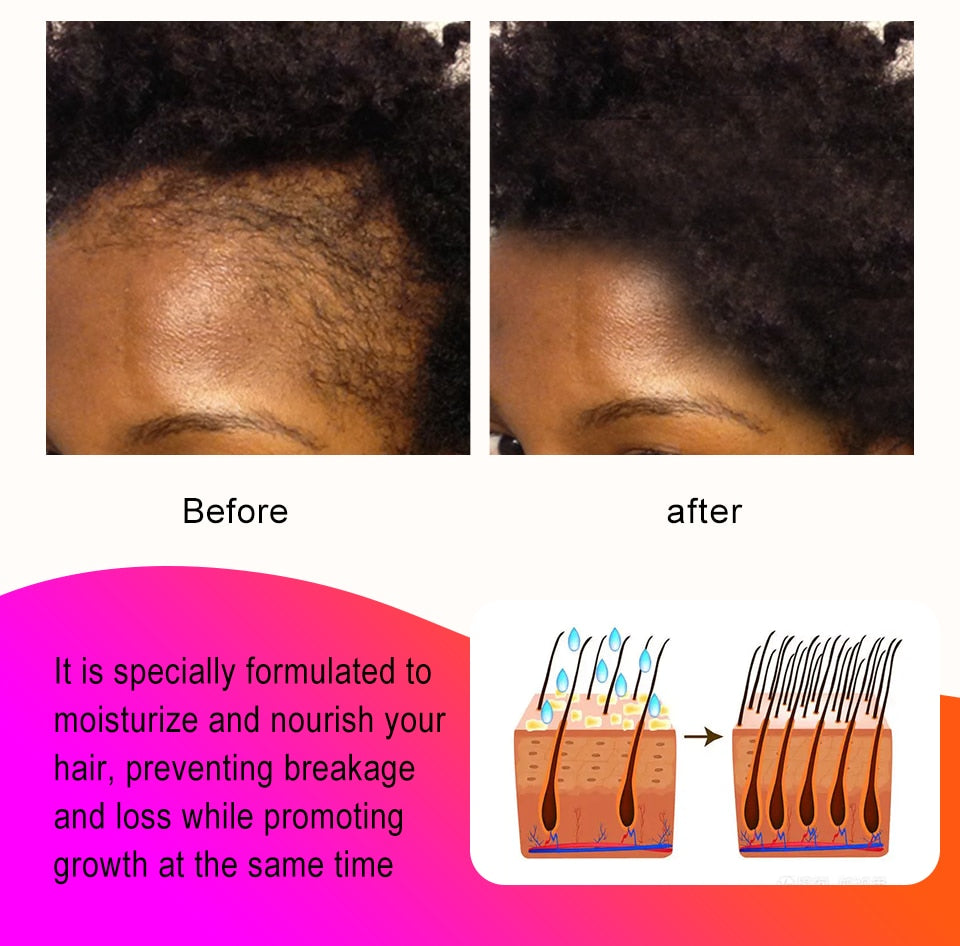 Fast Hair Growth Traction Alopecia Chebe Anti Hair Break